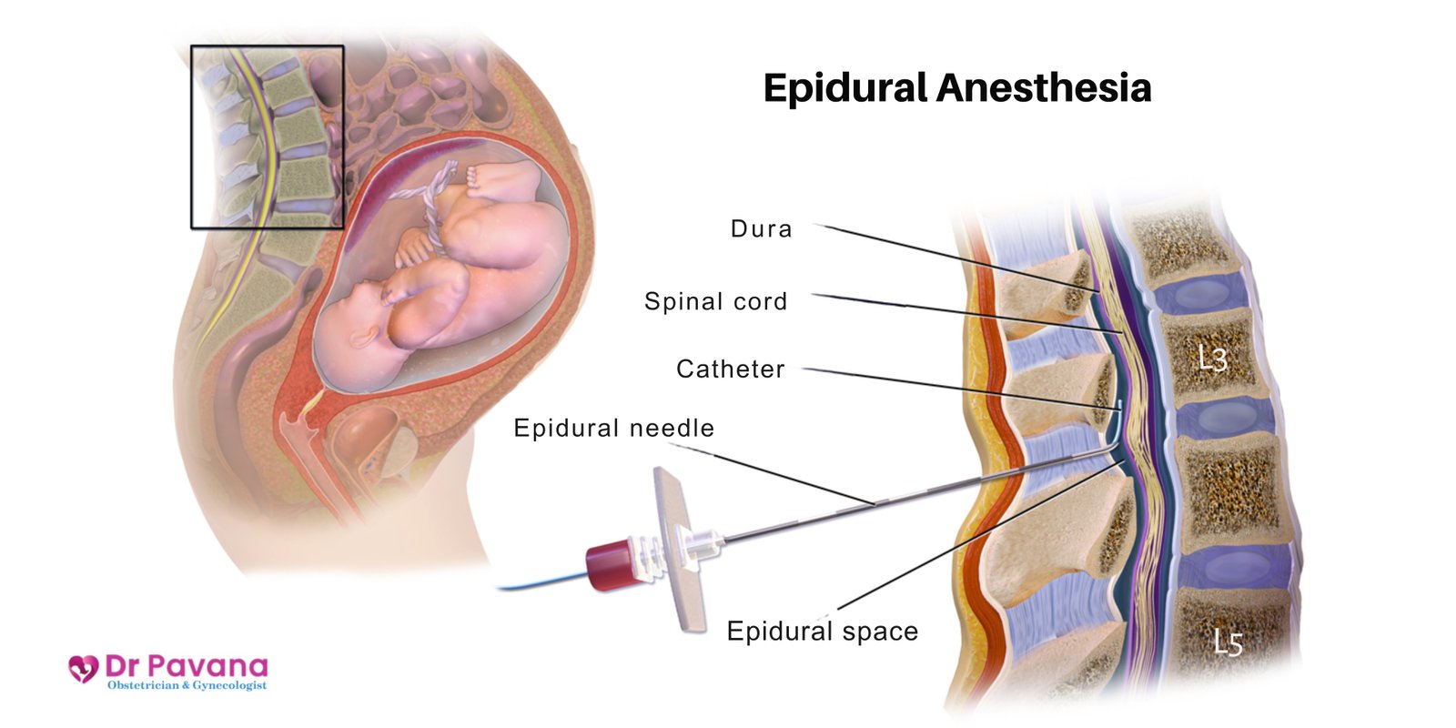 Dr-Pavana-HN-twin-pregnancy-care-monitoring-Greater-Noida-Ek-Murti