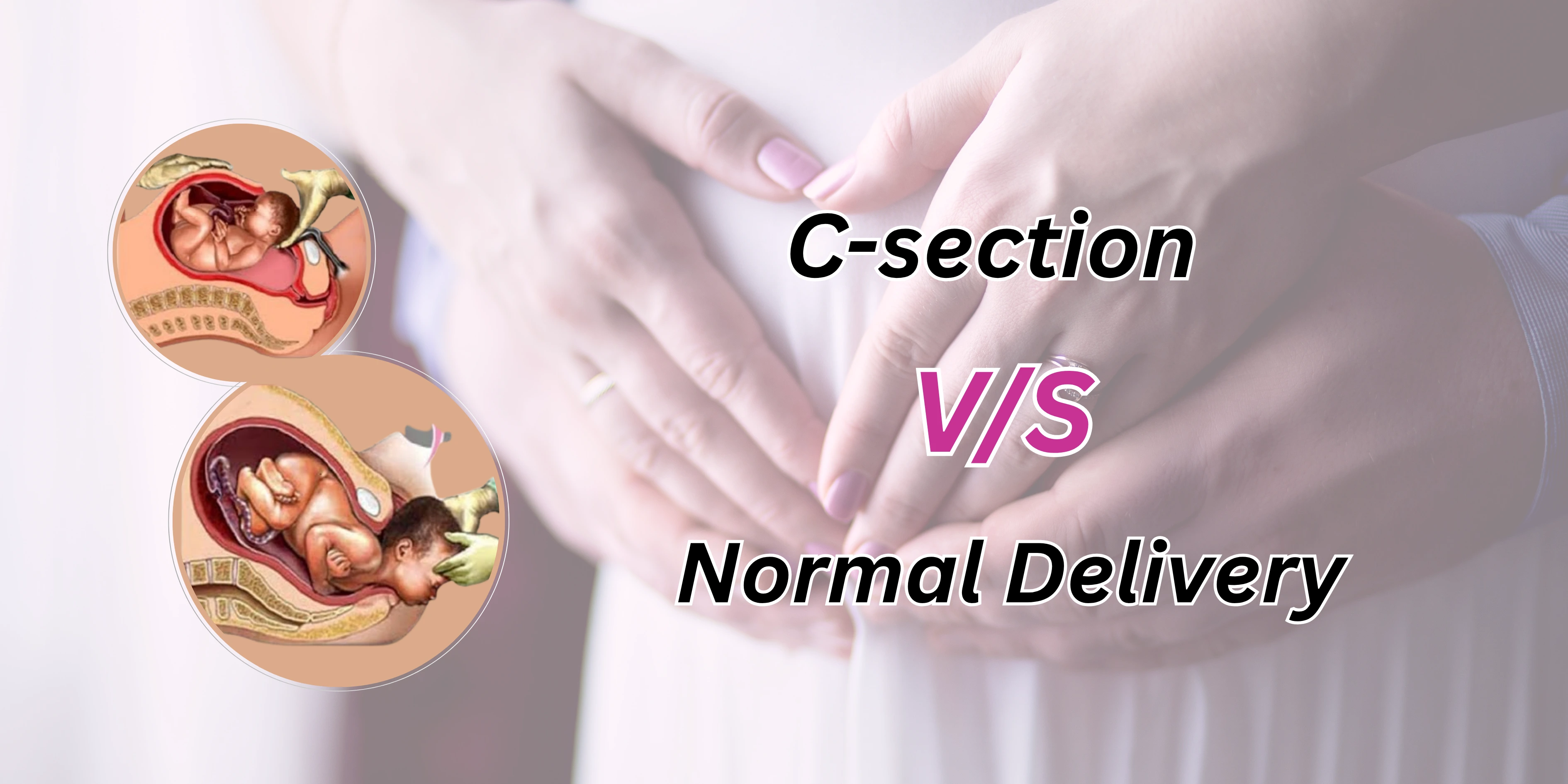 Best obstetrician gynecologist in Greater Noida West discussing when C-section is safer than normal delivery – trusted lady doctor in Noida Extension.