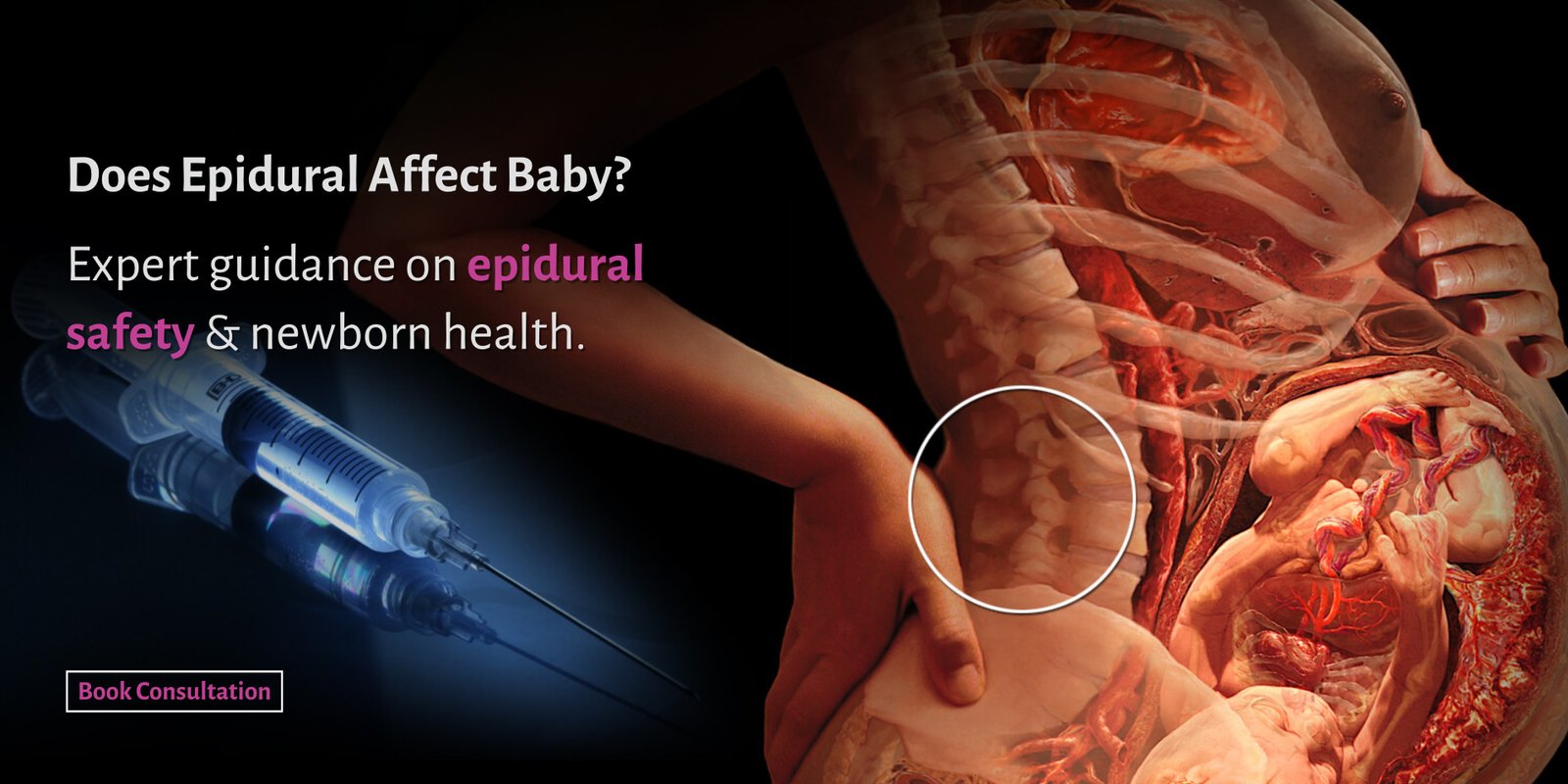 does-epidural-affect-baby-dr-pavana-hn-labor-pain-relief-greater-noida-ek-murti