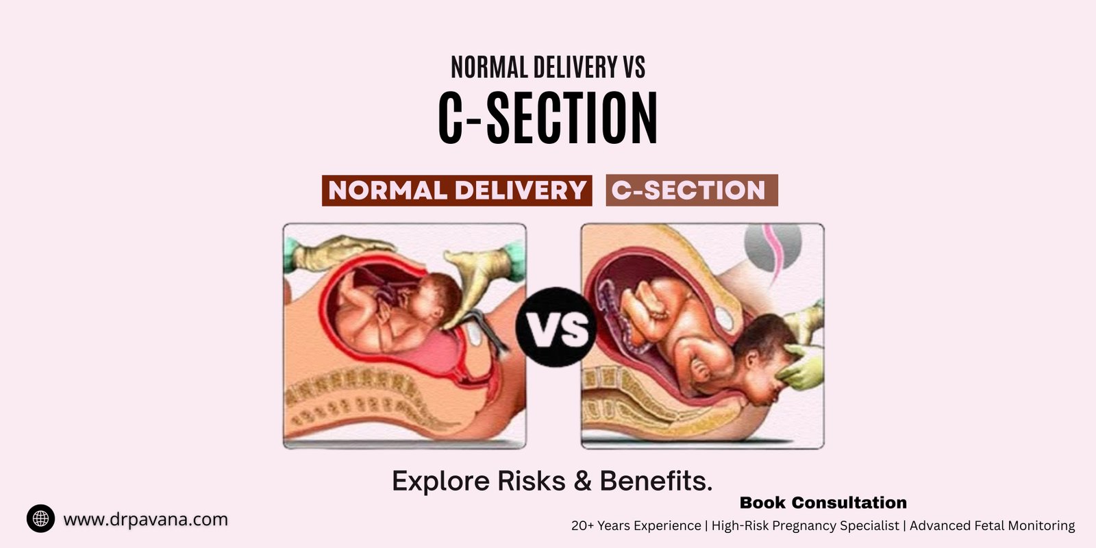 Normal-delivery-vs-c-section-dr-pavana-gynecologist-in-noida-explains-safe-birth-options